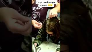 Pimples removal tiktok compilation  Extracting blackheads and whiteheads cystic acne [upl. by Nikolai]