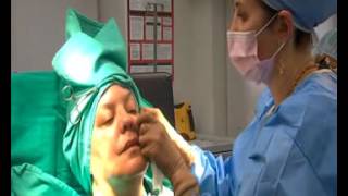 Silhouette Instalift NonSurgical Facelift Demonstration [upl. by Enyawud]