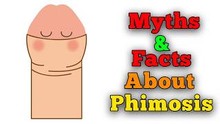 Myths And Facts About Phimosis Tight Foreskin [upl. by Nareik263]