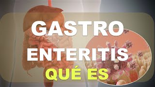 ¿Qué es la Gastroenteritis Explicación [upl. by Alby448]