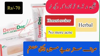 Anti acne cream dermi doc  Removing acne cream honest review by anmol beauty tips [upl. by Jacquelin]