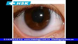 2009 Iridologia Software  East Iridology Hsk iriscope HSK Camara para iridologia Medicina Natural Holistica  Iridologia Acupuntura Florais Cromoterapia [upl. by Lananna]