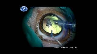 Visco Free IOL Implant in a Dog [upl. by Yllrebmik]