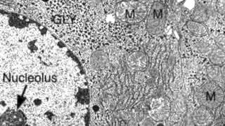 233 Identify structures from electron micrographs of liver cells [upl. by Funda]