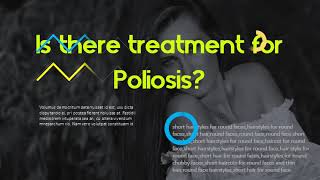 Is Poliosis permanent Is there treatment for Poliosis [upl. by Doretta]