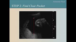 Ultrasound Training Course 10 part 1 [upl. by Efar51]