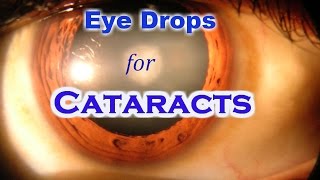 Lanosterol Eye Drops can cure Cataract without Surgery [upl. by Meehahs145]