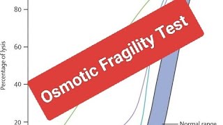 Leading Causes of Pediatric Normocytic Chronic Hemolysis HS [upl. by Rolyab455]