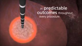 Covidien Emprint Ablation System with Thermosphere Technology [upl. by Ydnolem]