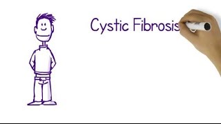 What Is Cystic Fibrosis [upl. by Akli]