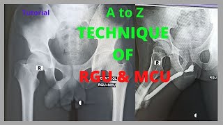 Technique of RGU amp MCU Ep31 Retrograde rethrogram and Micturating cystogram  Bangla Tutorial [upl. by Keeton]