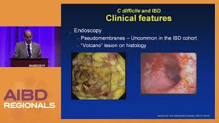 Prevention and Management of C Difficile Colitis [upl. by Gibbons]