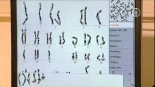 FWU  Chromosomen des Menschen  Erbkrankheiten und Karyogramme [upl. by Cornelie]