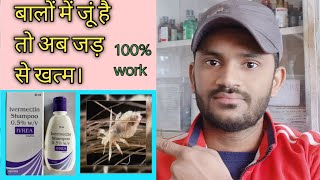 Ivrea shampu use benefits side effects full review in hindiपुरी जानकारी हिन्दी भाषा में [upl. by Rosenkrantz]