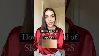 How to get rid of skin tags with pcos [upl. by Eardnaed]