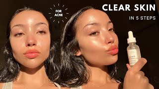 MY UPDATED SKINCARE ROUTINE  unsponsored skincare for acne [upl. by Amliv]