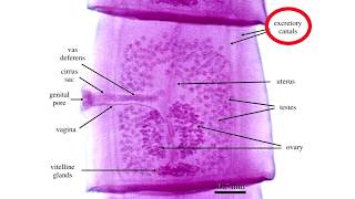 Diphyllobothrium Latum [upl. by Baggs]