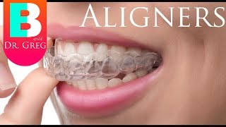 Things to Know Before Invisalign  Clear Aligner Therapy [upl. by Audy]