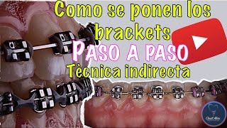 Colocación de brackets Damon [upl. by Studdard]