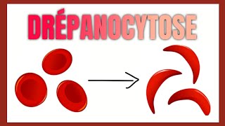 La drépanocytose  physiopathologie diagnostic traitement [upl. by Rangel]