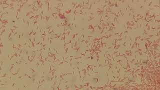 Moraganella morganii in Gram Staining [upl. by Anyr962]