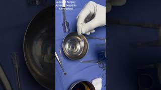 AUTOCART PROCEDURE FOR CARTILAGE FOR DEFECTS [upl. by Maxentia]