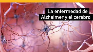 Cómo cambia la enfermedad de Alzheimer al cerebro [upl. by Nika]