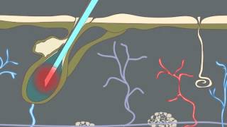 How Electrolysis Works Animation [upl. by Annadiana]