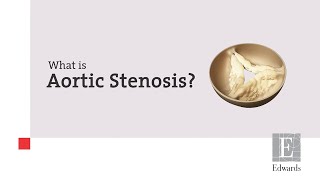 What is Aortic Stenosis [upl. by Dillie747]