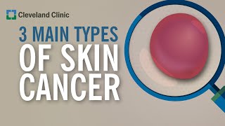 3 Types of Skin Cancer [upl. by Enael]