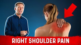 Shoulder Muscle Pain – Causes and Treatments for Relief by Dr Berg [upl. by Staw]