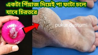 এক রাতে পা ফাটার থেকে মুক্তি পরো ঘরোয়া টিপসcarcked heels treatmentkitchen tipes amphakes [upl. by Atiuqad]