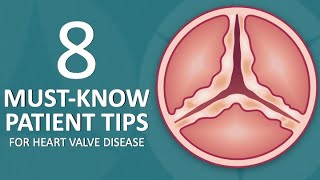 Patient Webinar 8 MustKnow Tips for Heart Valve Disease Patients [upl. by Fraya]