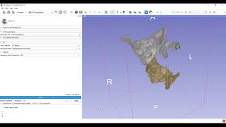 CPD Coherent Point Drift Rigid Registration in Slicer using Matlab Bridge [upl. by Eek]