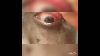 Watch at your own risk Mucus Eye Fishing Syndrome Eye Gunk Removal [upl. by Alyt149]