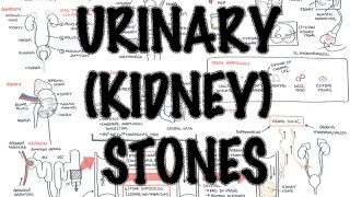 UrinaryKidney Stones  Overview signs and symptoms risk factors pathophysiology treatment [upl. by Amick268]