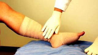 MultiLayer Compression Wraps for Venous Ulcers Understand Wound Care [upl. by Archibaldo361]