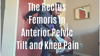 The Role of the Rectus Femoris in Anterior Pelvic Tilt and Knee Pain [upl. by Rocher]