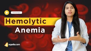 Hemolytic Anemia  Pathology Online Lectures  Medical Student Education  VLearning [upl. by Fedak]