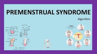 Premenstrual Syndrome Algorithm RCOG Guidelines with important MCQs [upl. by Flyn524]