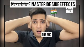 हिंदी Finasteride Side Effects Finasteride Before and after FINASTERIDE Results Hairloss Hindi [upl. by Sharos]