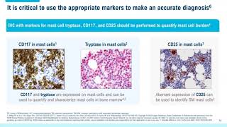 Systemic Mastocytosis Overview of Disease and Diagnosis for Pathologists [upl. by Atterual]