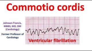 Commotio cordis [upl. by Uriisa]