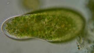 04 Paramecium bursaria com algas endossimbiontes [upl. by Viridissa]