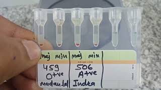 medicallabtechnologist6489 Blood Crossmatch Gel card method AgAbReaction MLT lab Blood [upl. by Dominik]