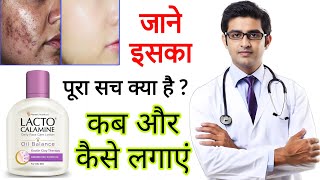 Lacto Calamine face lotion HONEST Review 2024 in hindi  Results Benefits Uses Price Information [upl. by Piselli]