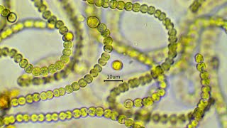 Nostoc commune  the nitrogen fixing cyanobacterium [upl. by Dodd583]