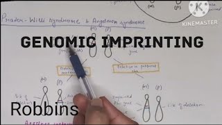 Genomic imprinting PraderWilli and Angelman syndrome Robbins हिंदी [upl. by Emylee]