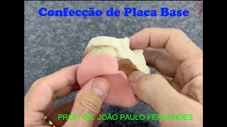 8  Confecção de placa base para Prótese Total [upl. by Rayna232]