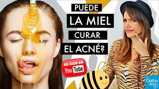 Mitos de YouTube La MASCARILLA DE MIEL cura el acné  Mafe Ampuero  Caribe Azul [upl. by Priscilla]